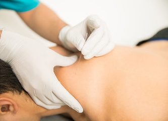 dry-needling-deception-bay